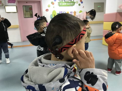 绵阳丨及时发现 干预 治疗 听障儿童也能聆听精彩未来