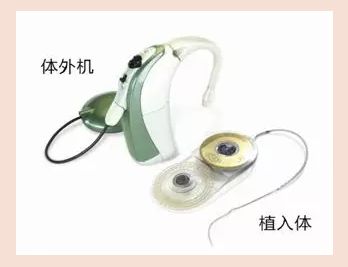 解剖人工耳蜗