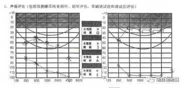 人工耳蜗典型案例