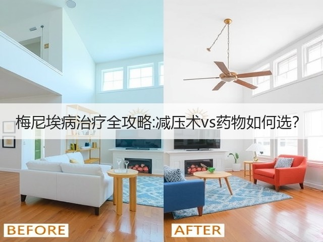 梅尼埃病治疗全攻略:减压术vs药物如何选?(图1) 梅尼埃病治疗全攻略:减压术vs药物如何选?(图1)