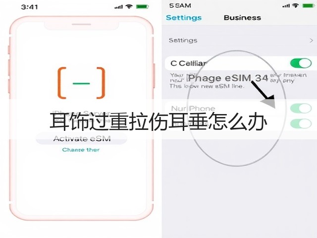 耳饰过重拉伤耳垂怎么办(图1) 耳饰过重拉伤耳垂怎么办(图1)